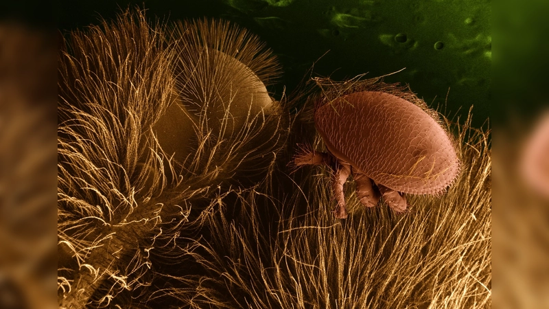 Die schädliche Varroamilbe auf einer Biene im Rasterelektronenmikroskop. (Foto: gemeinfrei)