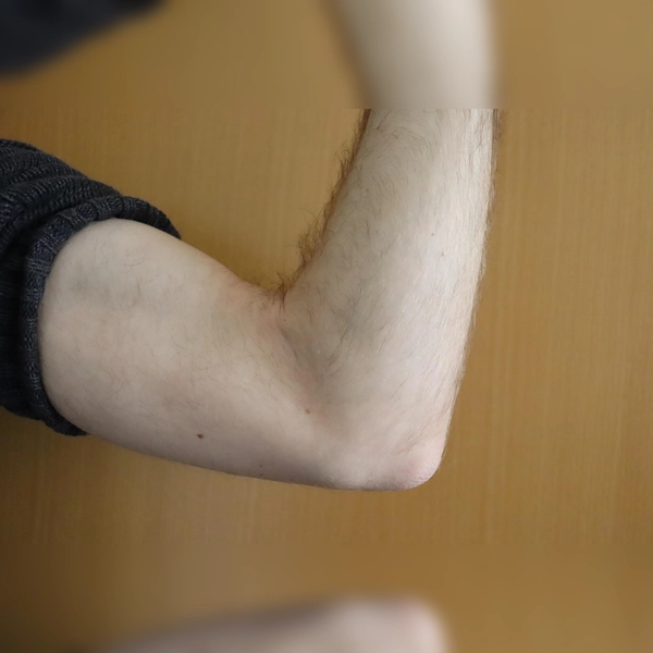 Mit „Muckis für alle” stellt die Stadt ein breites Fitnessangebot zum kleinen Preis zur Verfügung. Man kann ohne Anmeldung teilnehmen; dadurch ist es auch für Kurzentschlossene ein toller Tipp.  (Foto: mha)